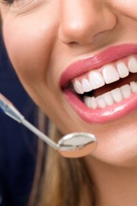 igienista dentale a Roma