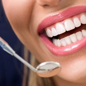 igienista dentale a Roma