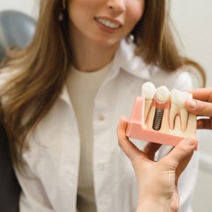 impianti dentali a Roma Prati
